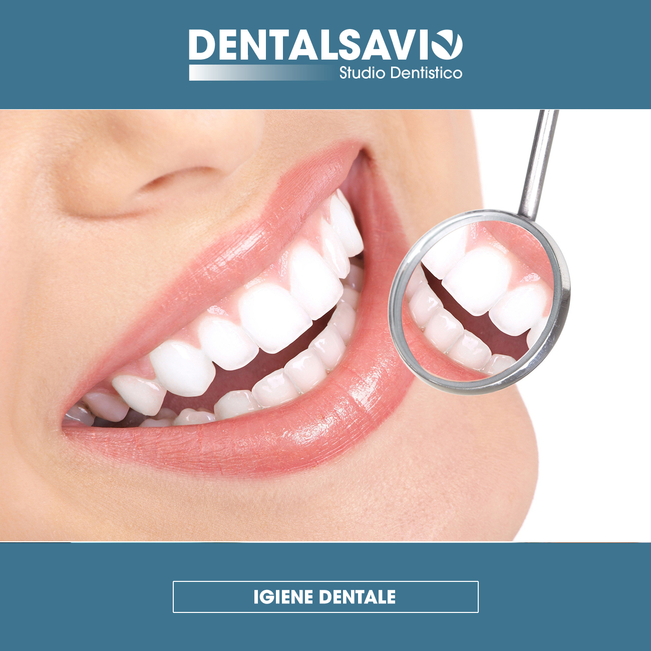 igiene dentale