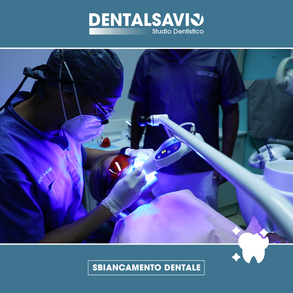 SBIANCAMENTO sbiancamento dentale dentalsavio