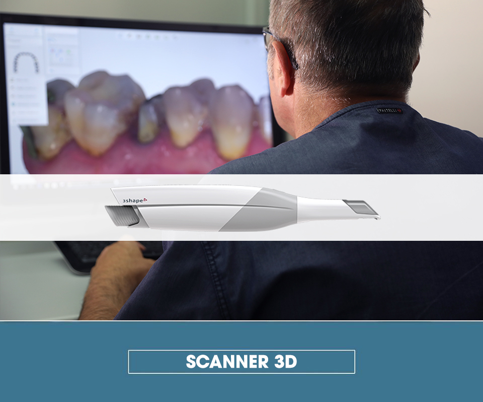 telecamera-3D copia scanner 3d